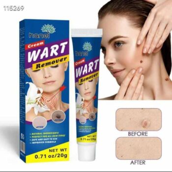 Wart remover
