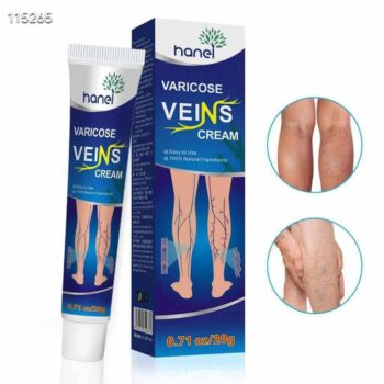 Varicose veins cream